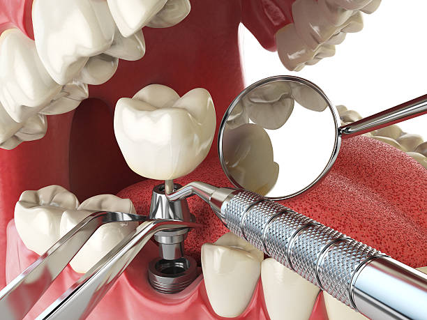 Best Emergency Treatment for Toothache in Munford, AL